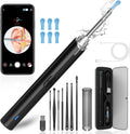 Clarova Vision Ear Cleaner - 1296p HD camera ear wax removal kit